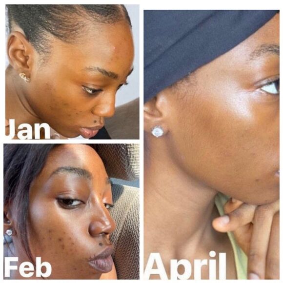 Sunday Riley Good Genes Lactic Acid Treatment - Picture 7 of 15